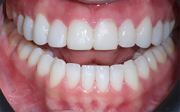 6-after