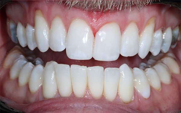 7-after